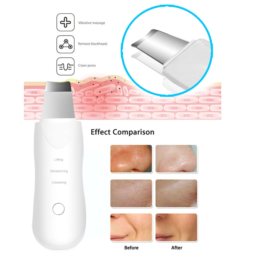 Épurateur de peau à ultrasons, nettoyeur de visage vibrant en profondeur