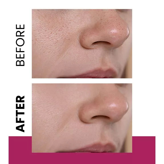 🌟 Newwell – Crème Rénovatrice Anti-Taches 50 ml