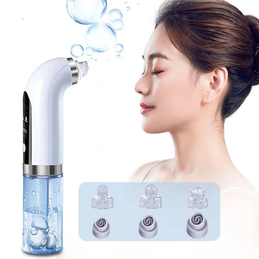 Aspirateur de pores noir, nettoyeur électrique à micro-bulles