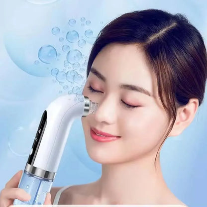 Aspirateur de pores noir, nettoyeur électrique à micro-bulles