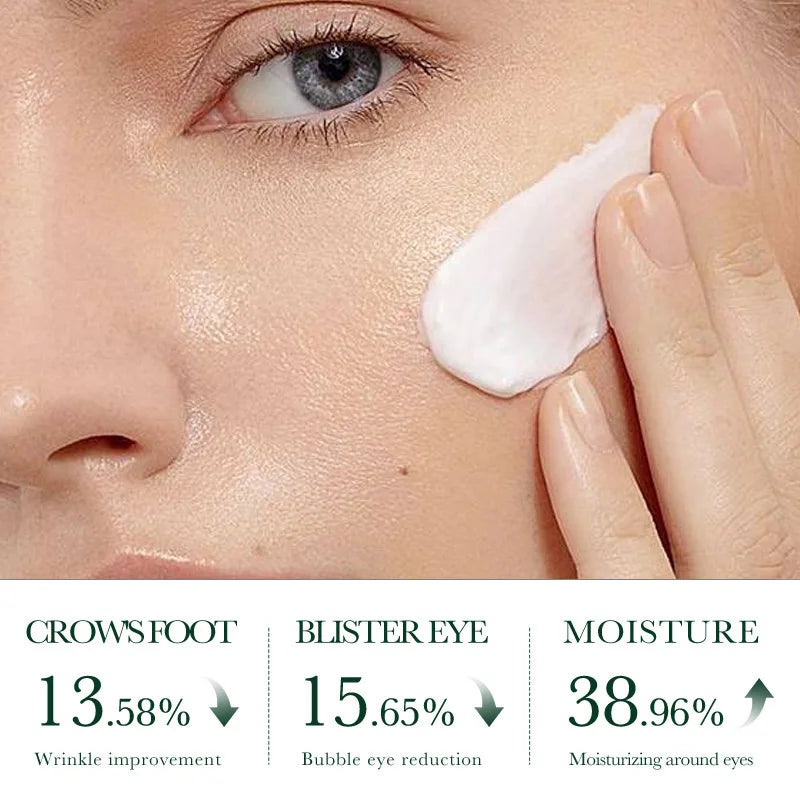 Crème visage SADOER au Tea Tree – Anti-acné & Contrôle de l’huile