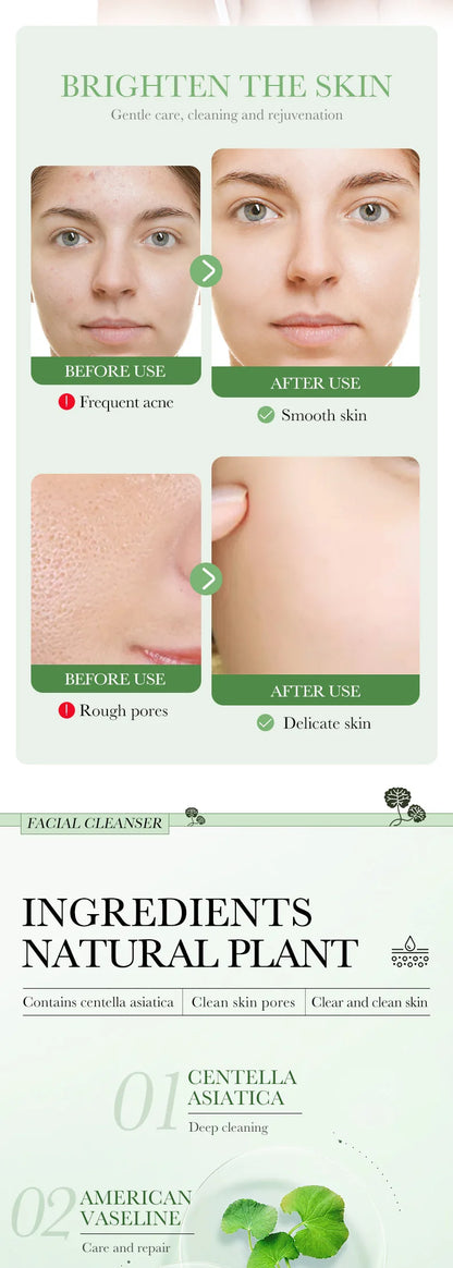 Nettoyant Visage BIOAQUA à la Centella Asiatica – Gel moussant hydratant & contrôle sébum