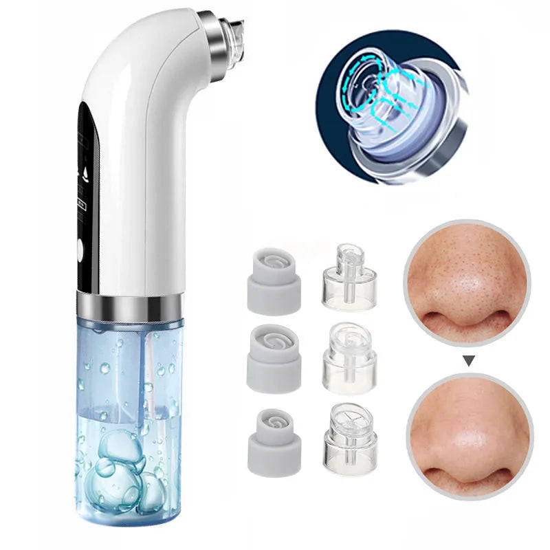 Aspirateur de pores noir, nettoyeur électrique à micro-bulles