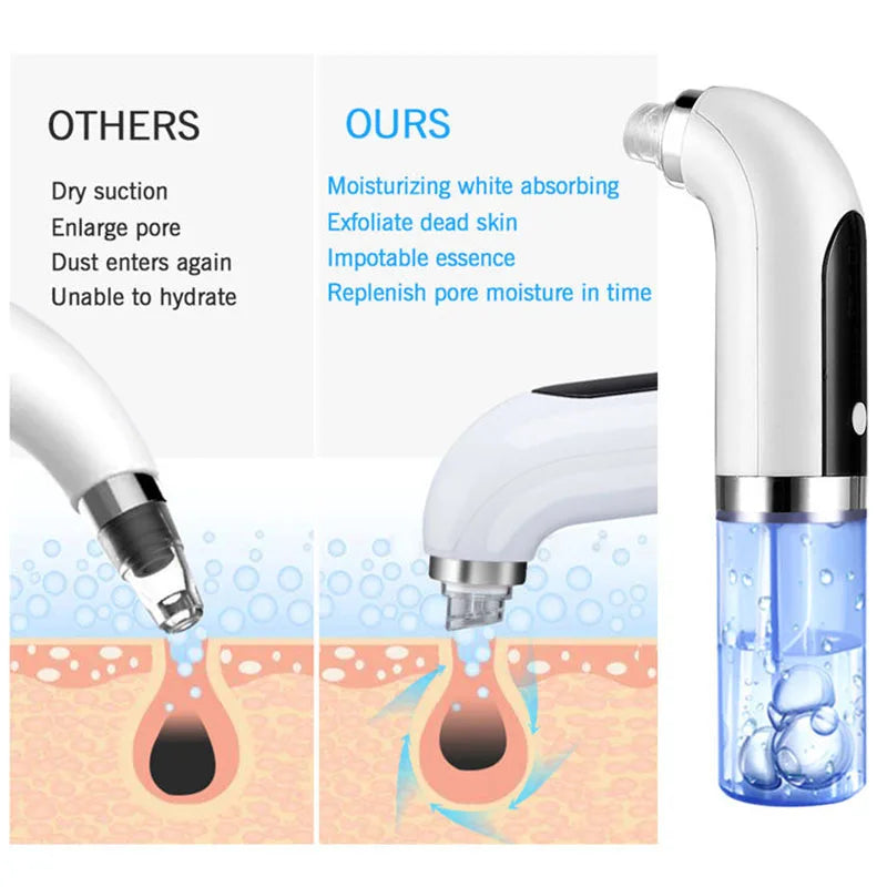 Aspirateur de pores noir, nettoyeur électrique à micro-bulles