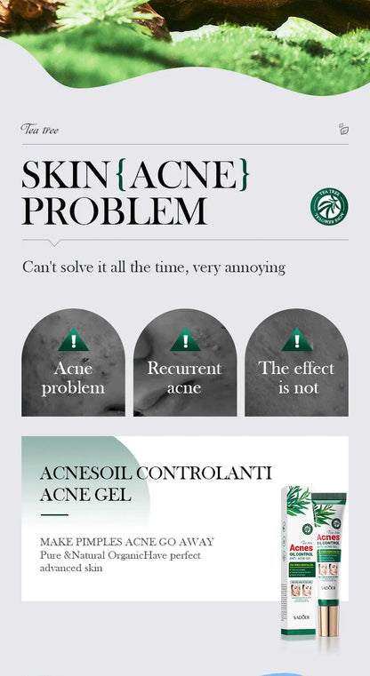 Gel crème hydratante SADOER au Tea Tree – Anti-acné et hydratante, idéale pour les adolescentes