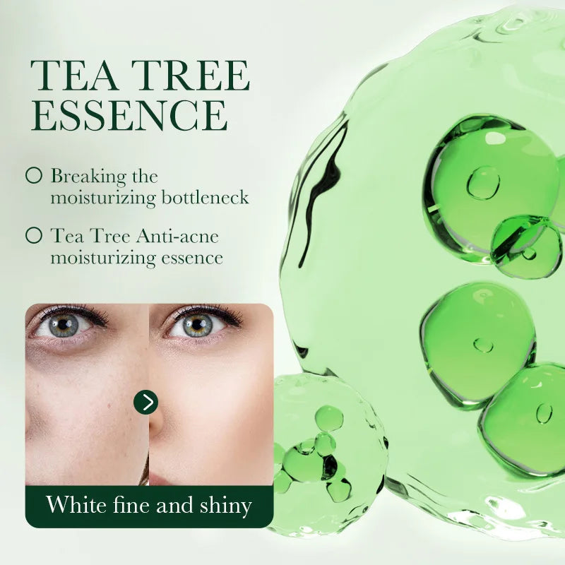 Crème visage SADOER au Tea Tree – Anti-acné & Contrôle de l’huile