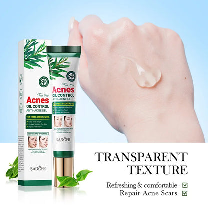Gel crème hydratante SADOER au Tea Tree – Anti-acné et hydratante, idéale pour les adolescentes
