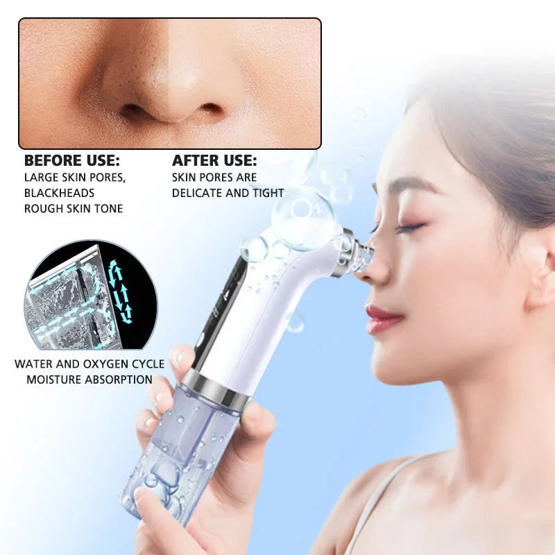 Aspirateur de pores noir, nettoyeur électrique à micro-bulles