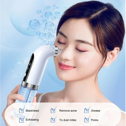 Aspirateur de pores noir, nettoyeur électrique à micro-bulles